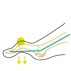 Compressana Tape Sox Hammerzehe