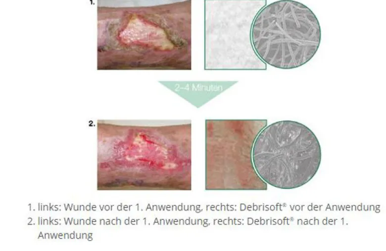 L+R Debrisoft Pad