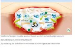 L+R Suprasorb A+Ag Calciumalginat Verband