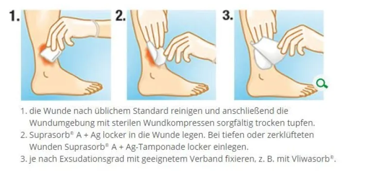 L+R Suprasorb A+Ag Calciumalginat Verband