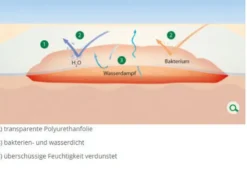 L+R Suprasorb F Folien Wundverband