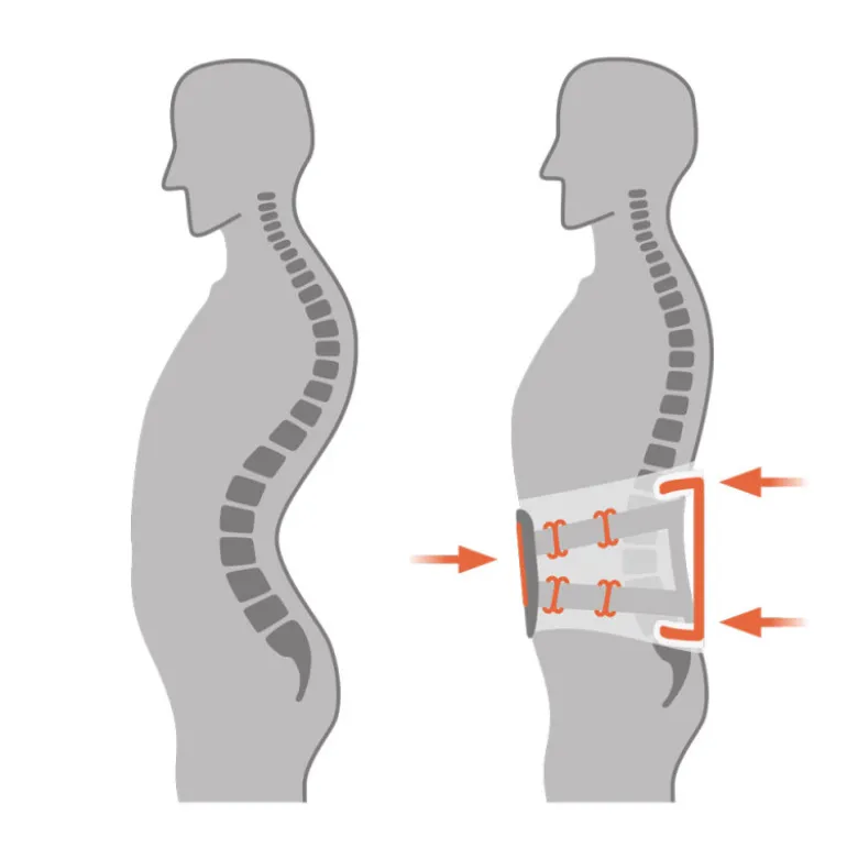 Rückenorthese SPORLASTIC Vertebradyn-Force