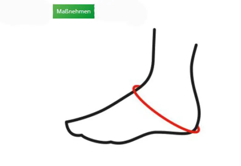 Sprunggelenkorthese L+R Cellacare Tarsotec Expert